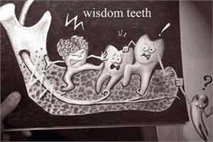 Зачем нужны зубы мудрости