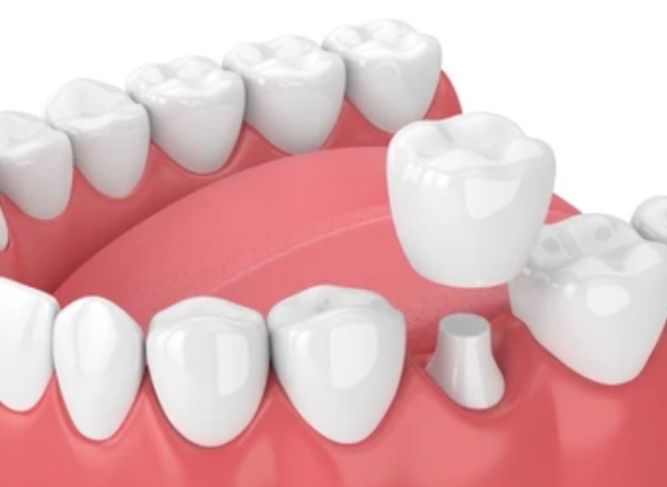 Примеры работ нашей стоматологии