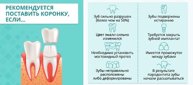Показания к установке коронок