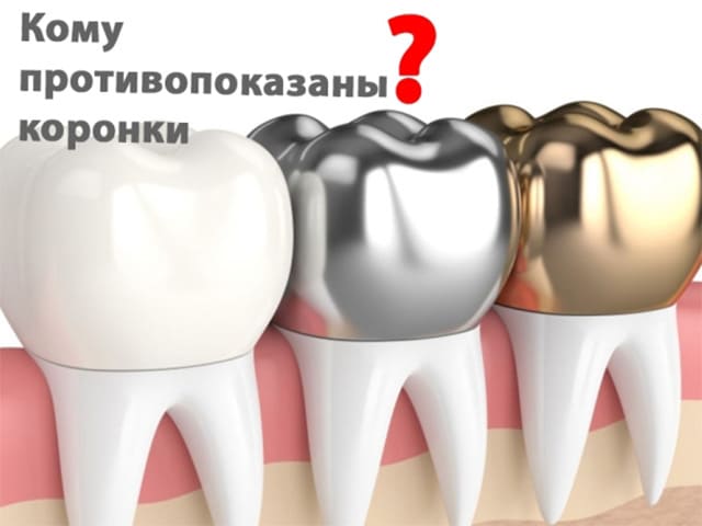 Противопоказания к коронкам