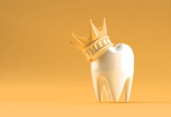 Рейтинг зубных коронок
