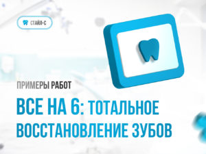 Все на 6: тотальное восстановление зубов